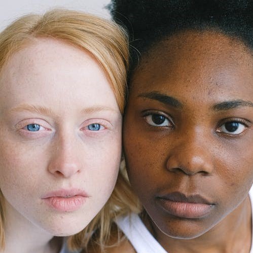 Image of two young women with beautiful skin. One woman is white and the other is black.