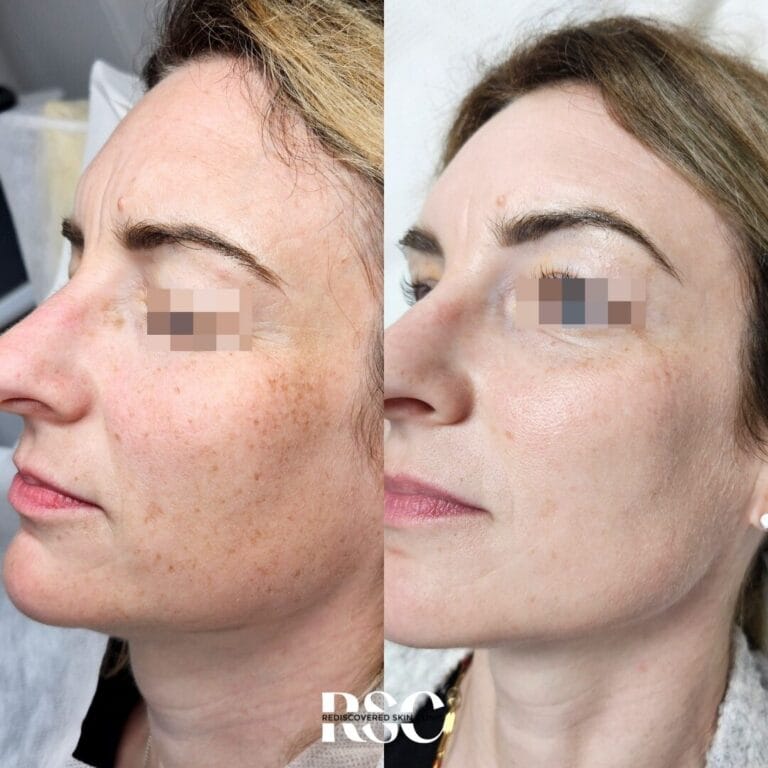 20240628_170337_0000