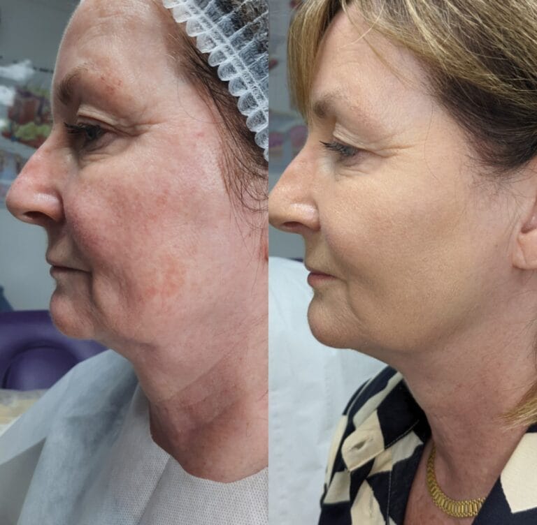 Collage 2021-09-22 15_56_13