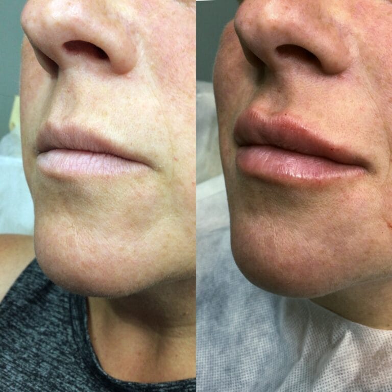 Collage_2024-08-21_18_04_39