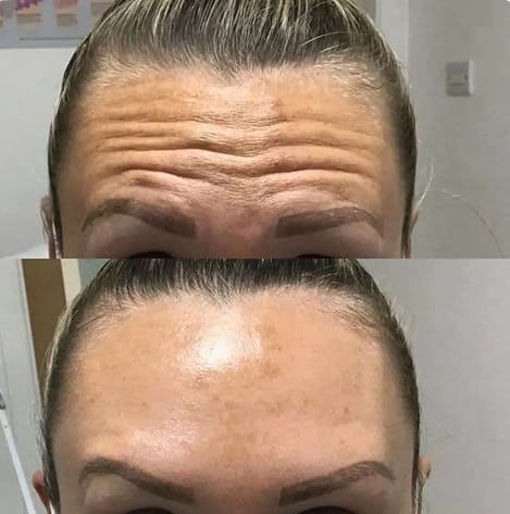 See Our Beautiful Results1