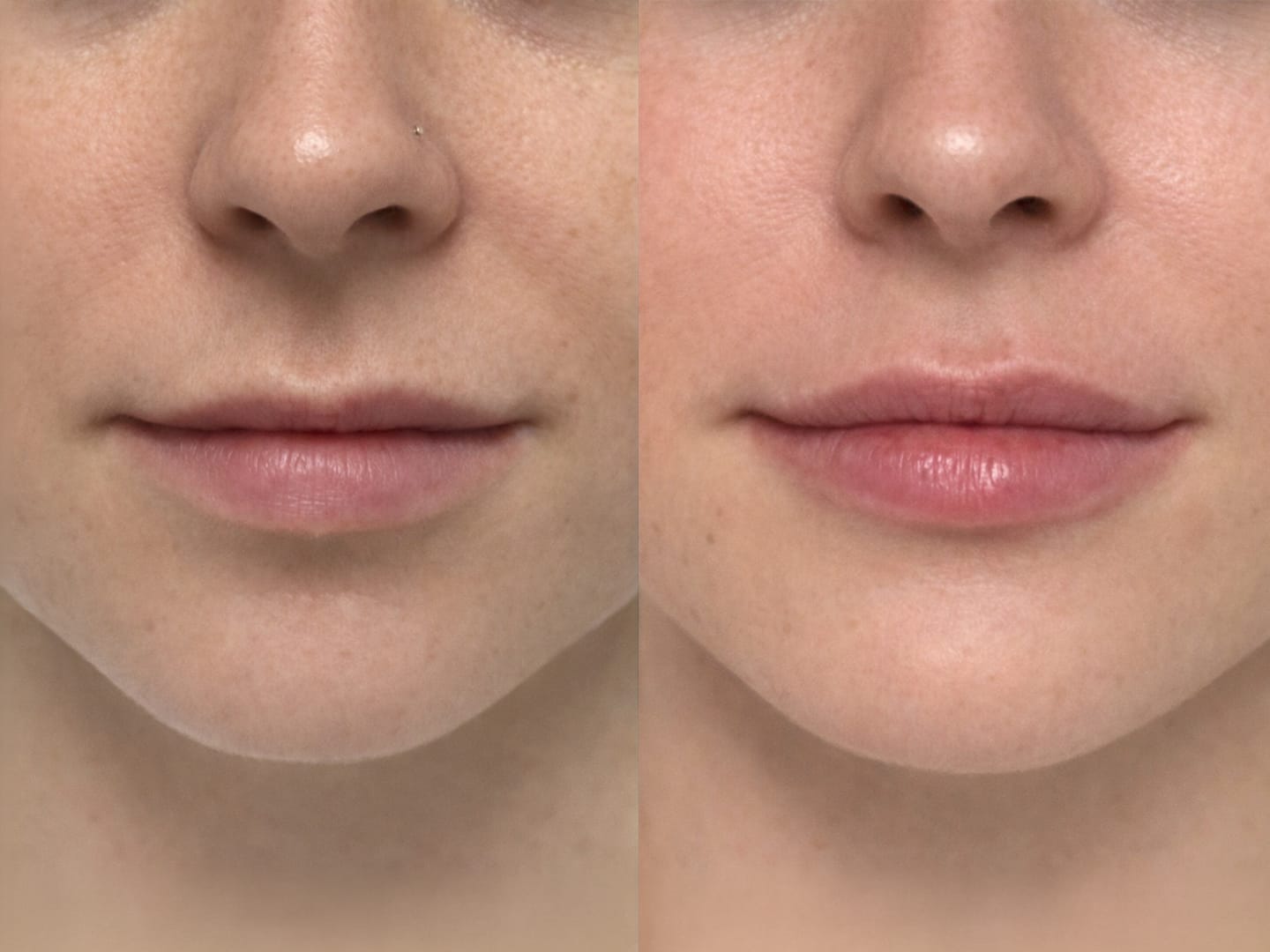 Lips 1